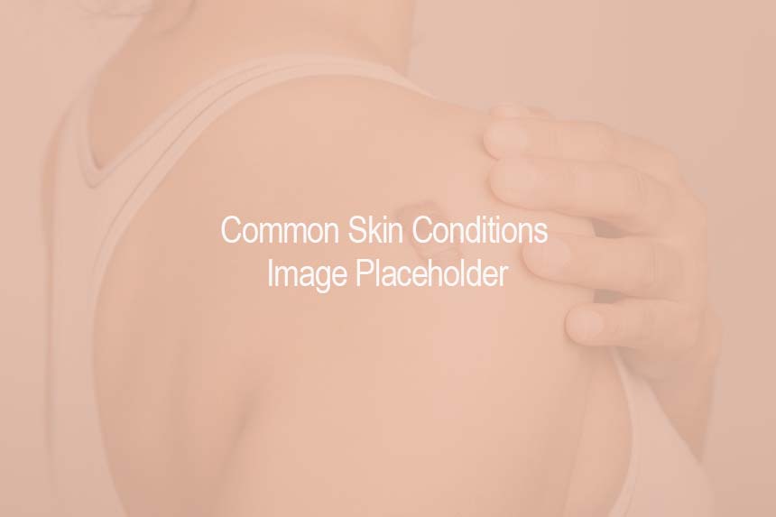 Common Skin Conditions Placeholder