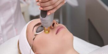 Laser Treatment