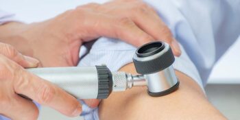 Mole Check And Skin Cancer Screening