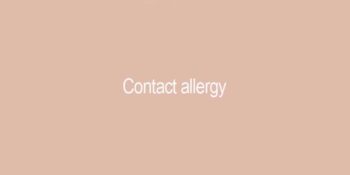 Contact Allergy
