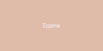 Eczema