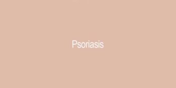 Psoriasis