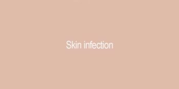 Skin Infection
