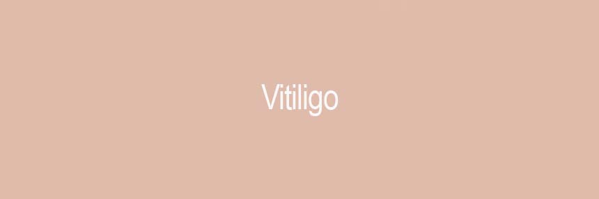 Common Skin Conditions - Vitiligo